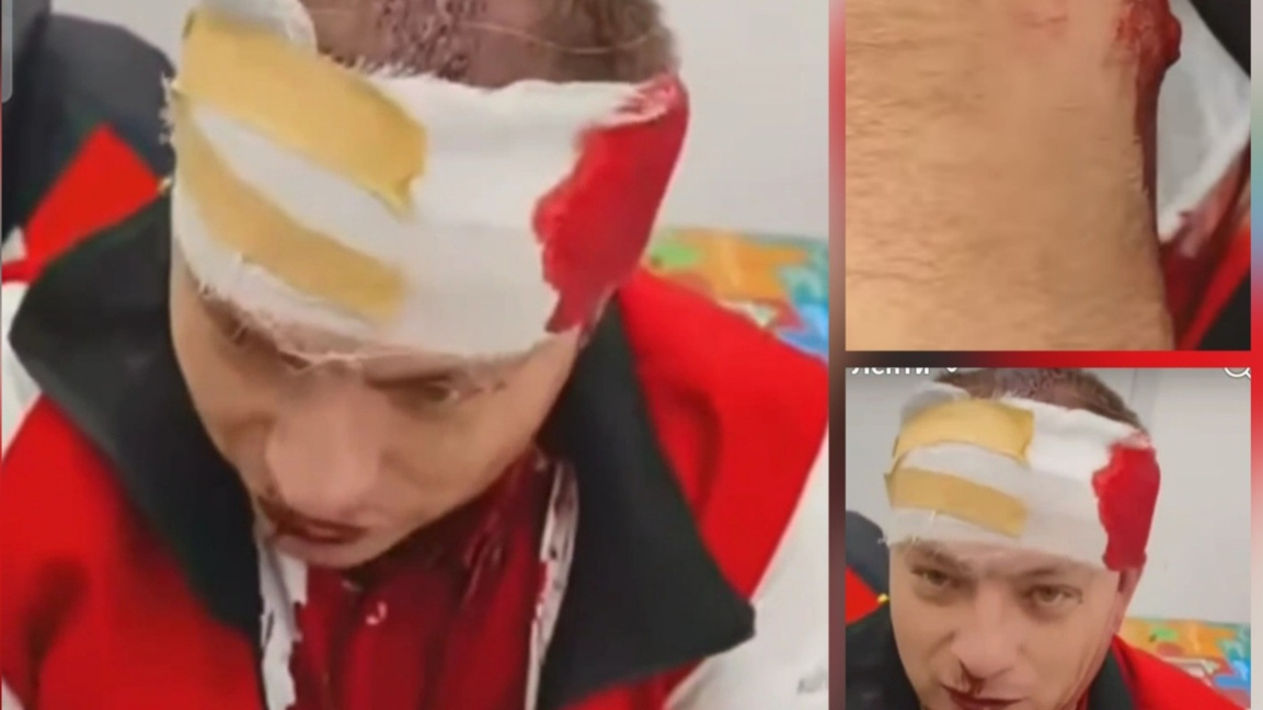 Разследват жестокия побой над координатора на "Величие" в Гоце Делчев