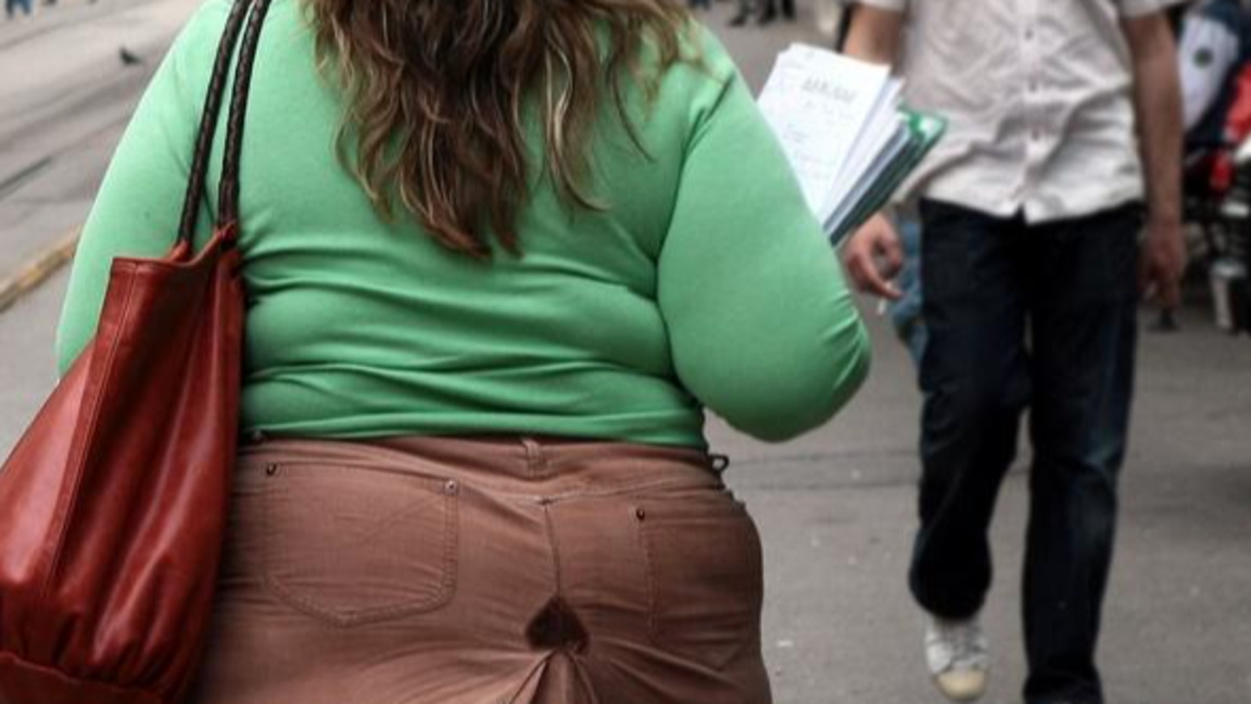 За затлъстяването като здравен и икономически проблем говорят специалисти