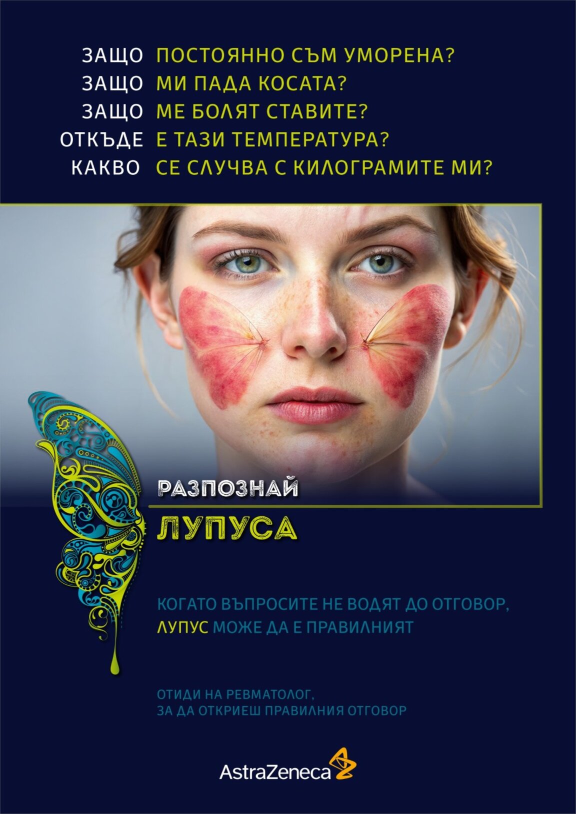 Ревматолог: Лупусът може да увреди различни органи