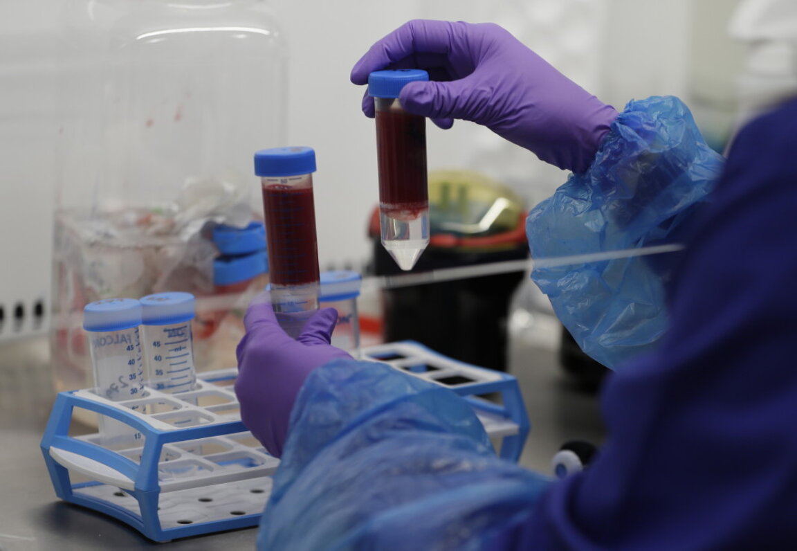 Почти всеки трети с хепатит остава без лечение у нас