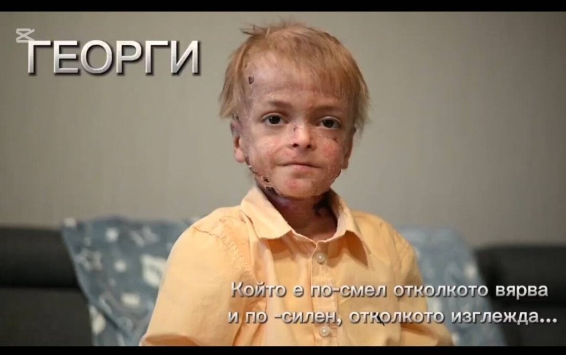 Анна Йончева създаде филм за "пеперуденото момче" Гого - герой и мъдрец, който ни учи на емпатия
