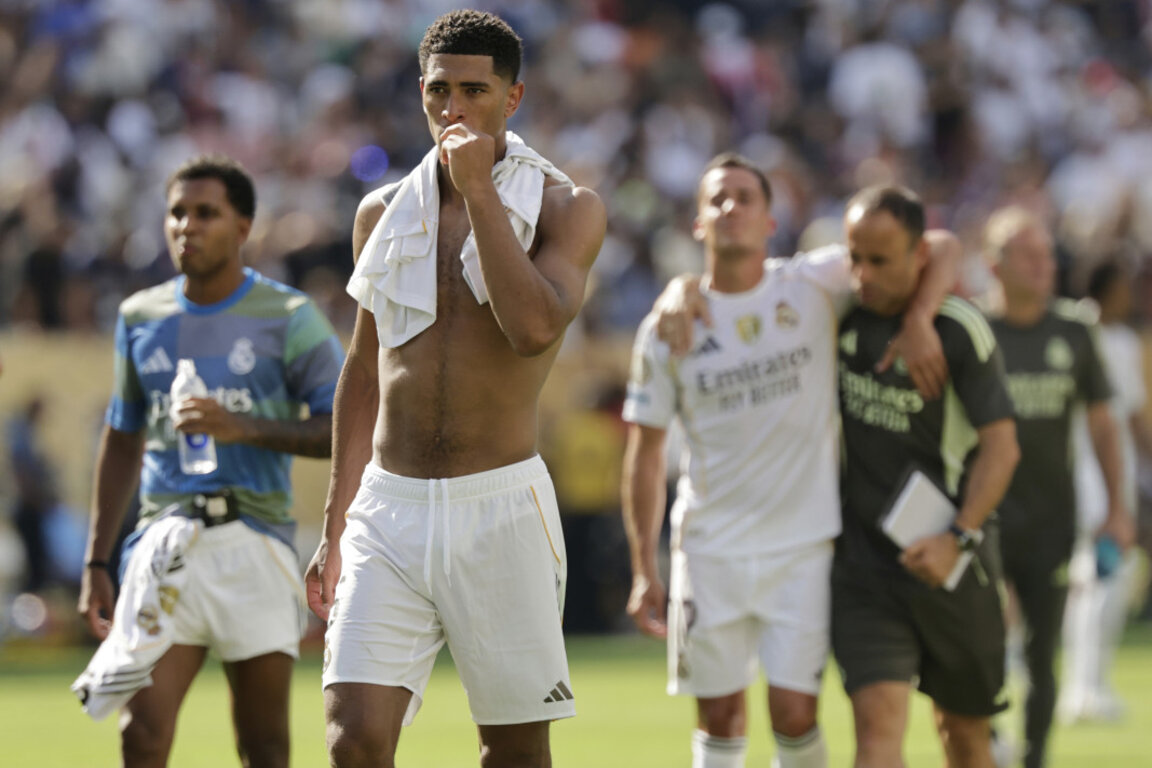 Оперираха Джуд Белингам, ще отсъства до октомври