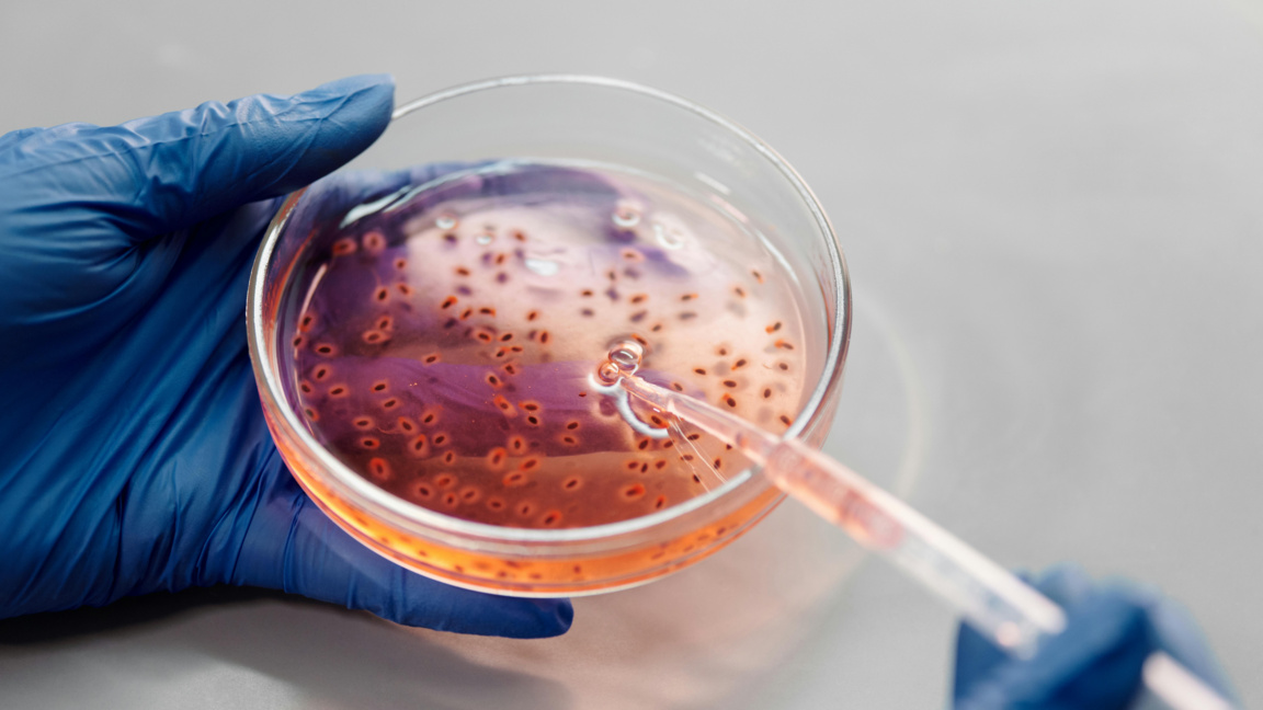 Отчетена е антимикробна резистентност при бактерии, срещани в храни