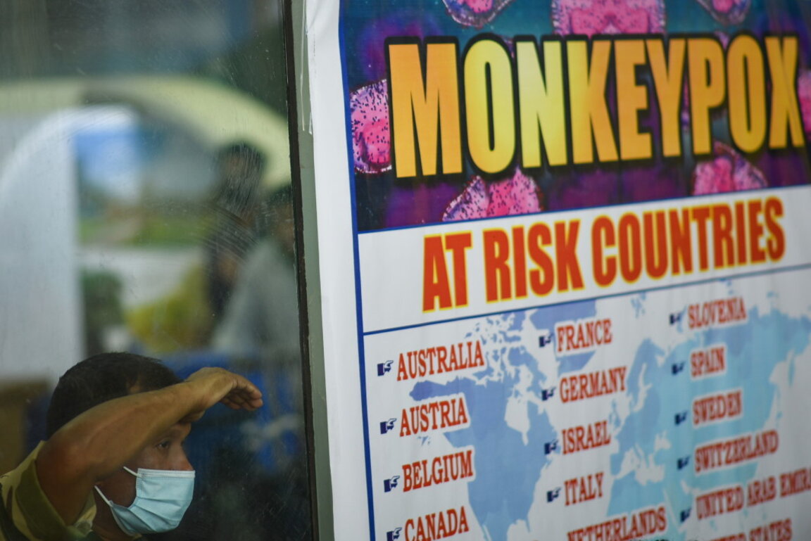 Second monkeypox case this year reported in Sofia