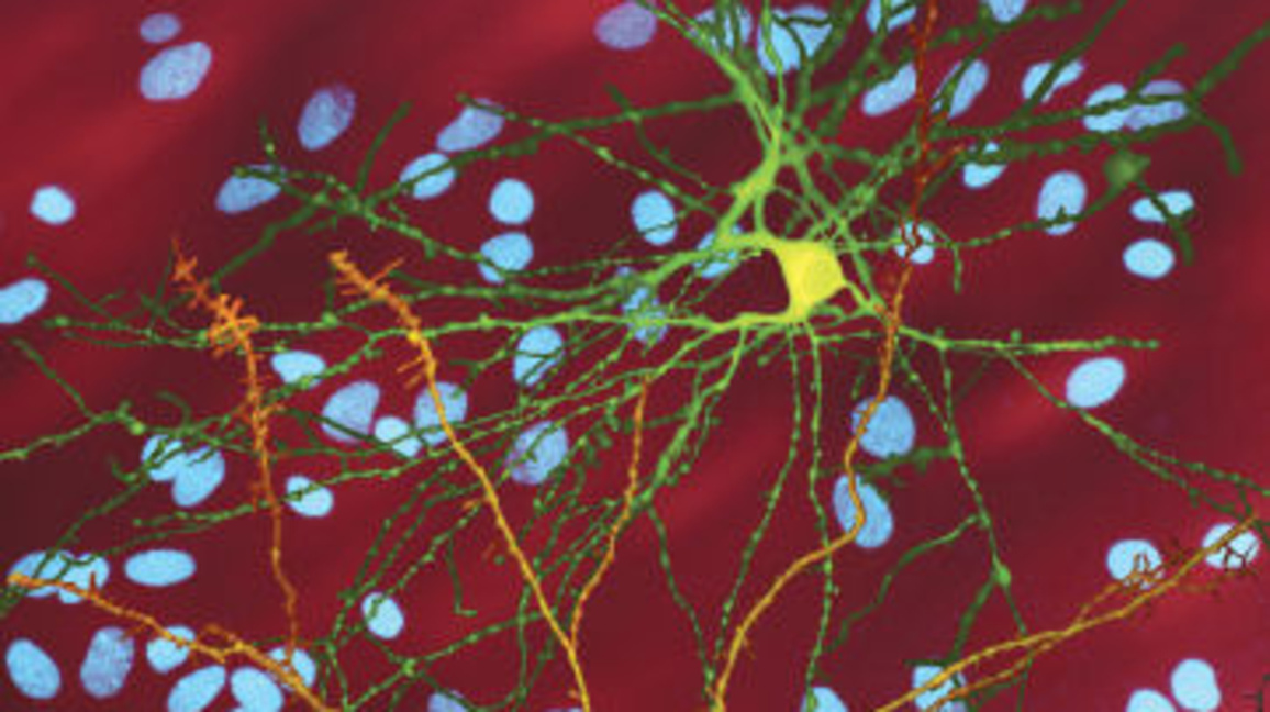 Живот с рядко заболяване и липса на близки