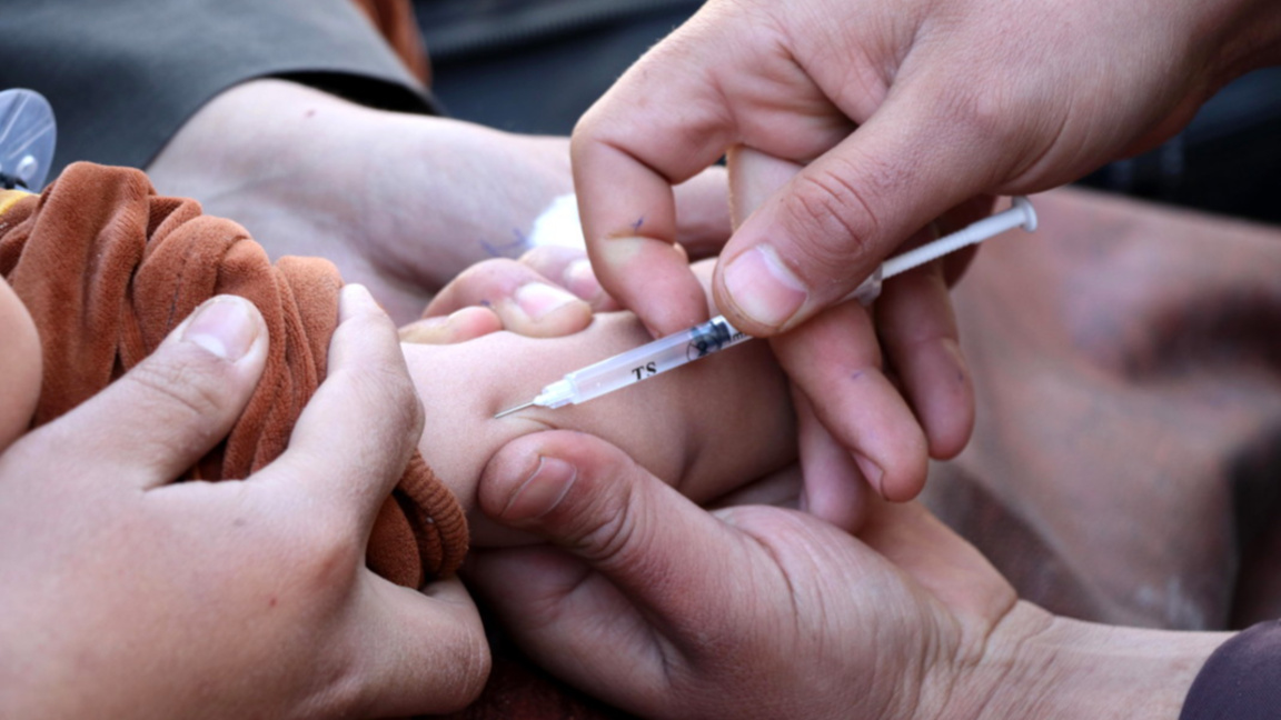 морбили шарка ваксинация