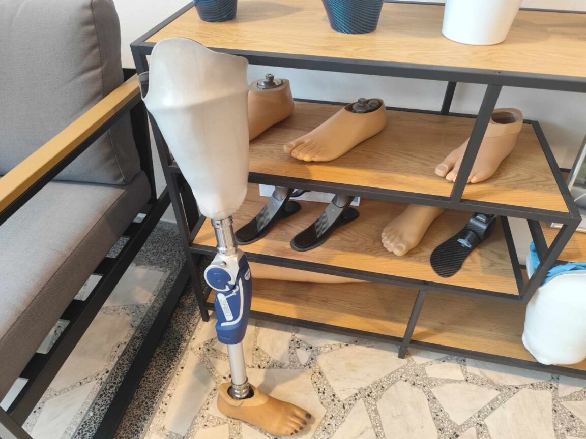 Хората с протези ощетени от нови правила на Здравната каса