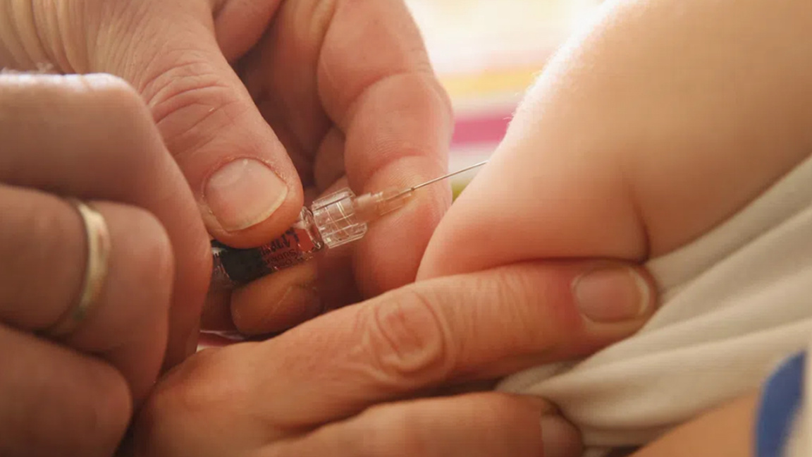 Три случая на морбили сред деца във Варна