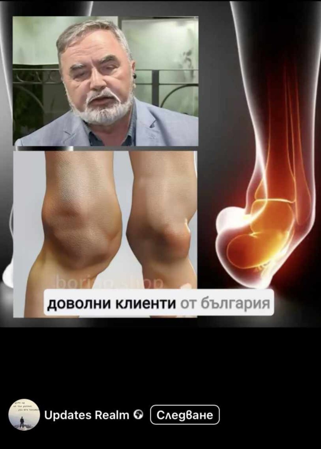 Фалшиви рекламни клипове на крем за стави с магическо действие за 3 дни