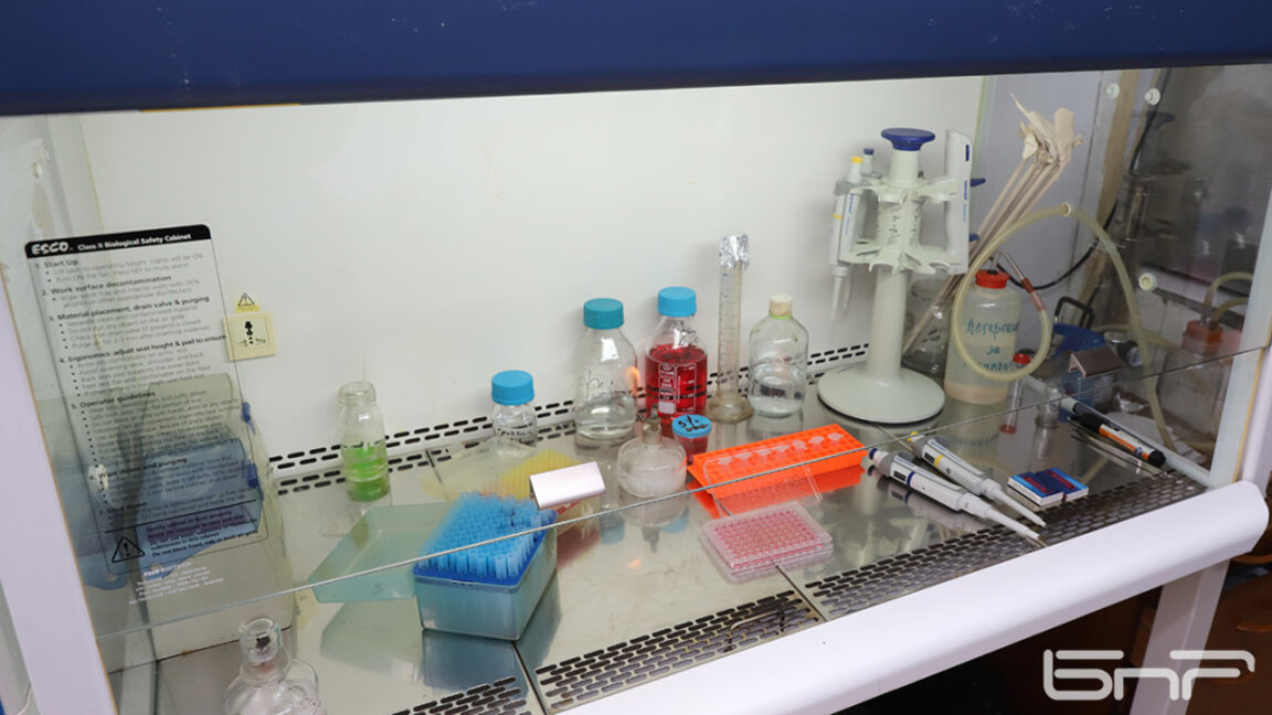 МЗ: Регистриран е внeсен случай на холера в България