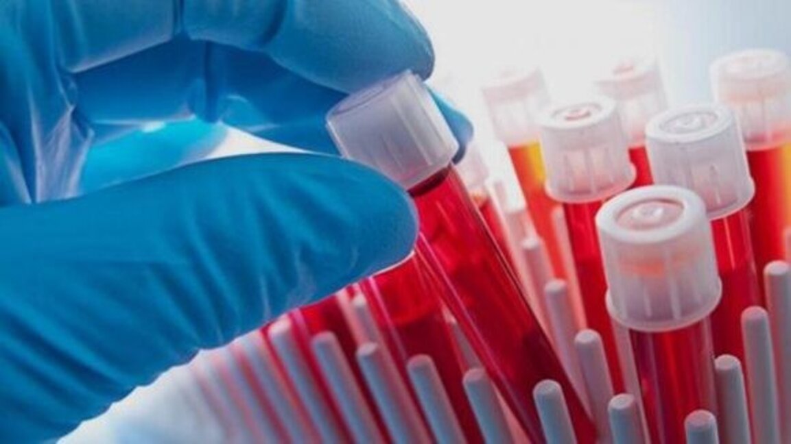 Хашимото засяга 4 пъти повече жените, отколкото мъжете