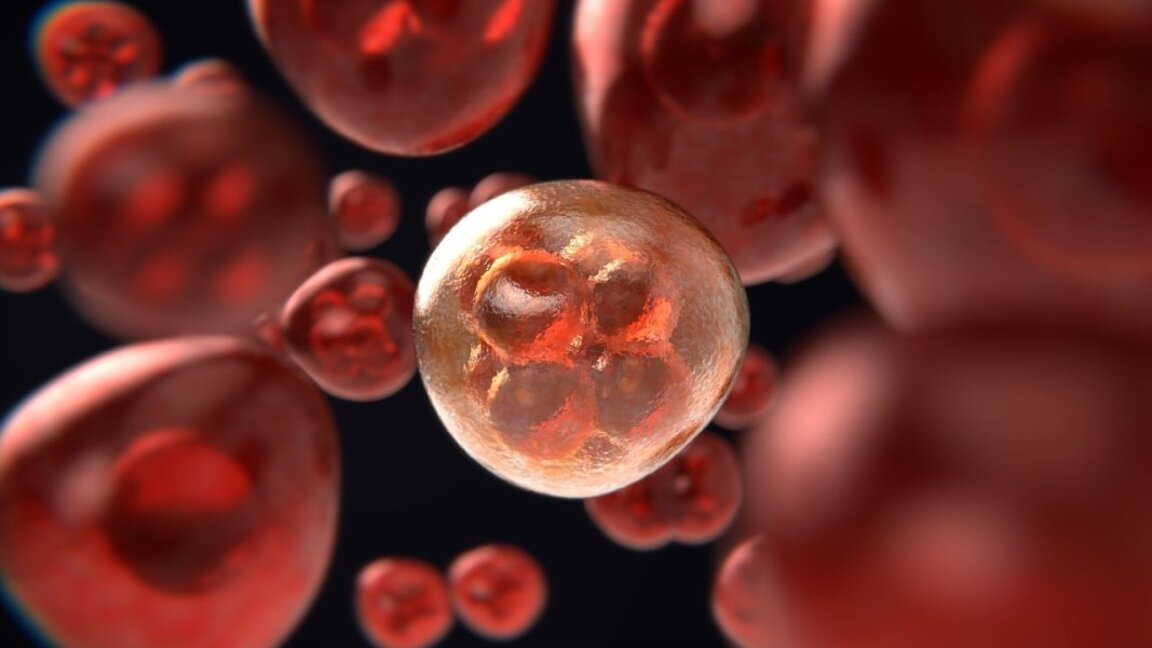 Le nombre de cancers augmente en Bulgarie