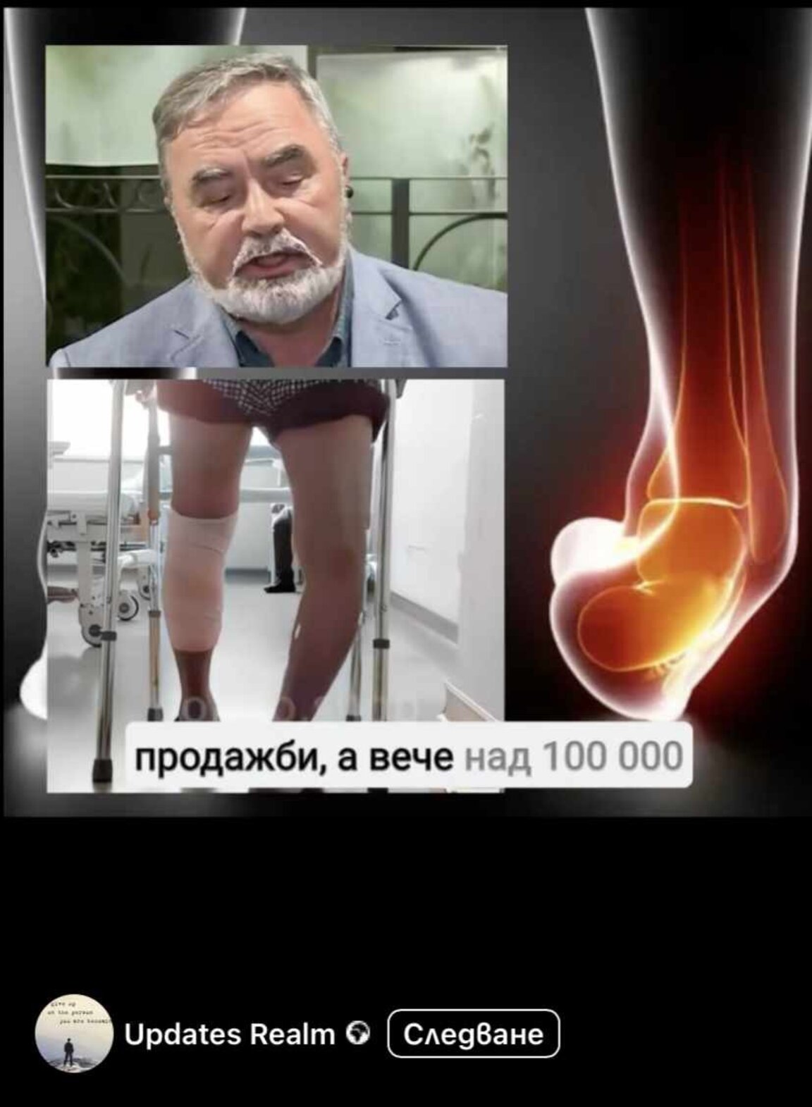 Фалшиви рекламни клипове на крем за стави с магическо действие за 3 дни