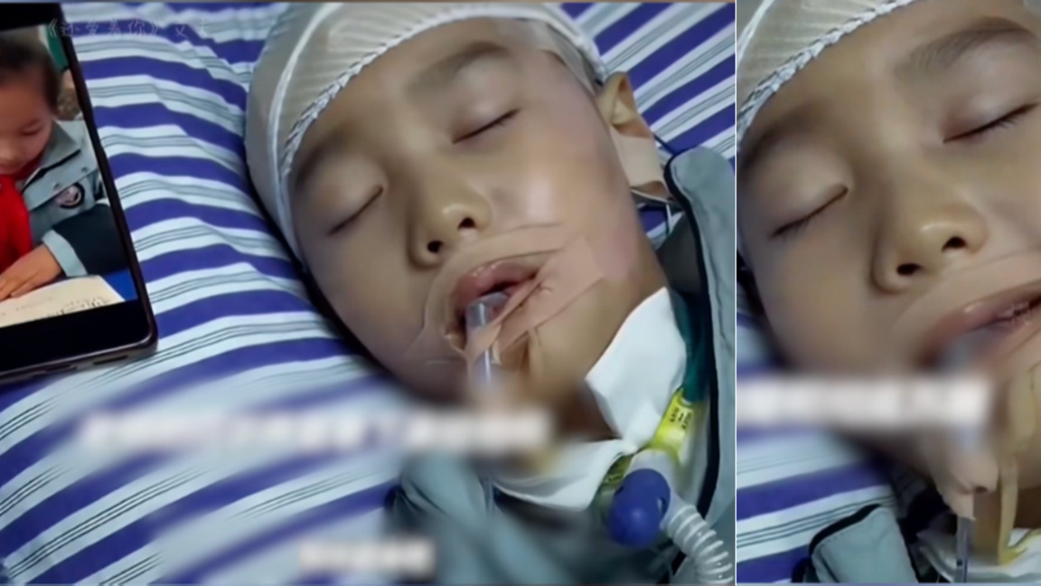 Чудо от Китай: Момче чу гласовете на съучениците си и излезе от комата