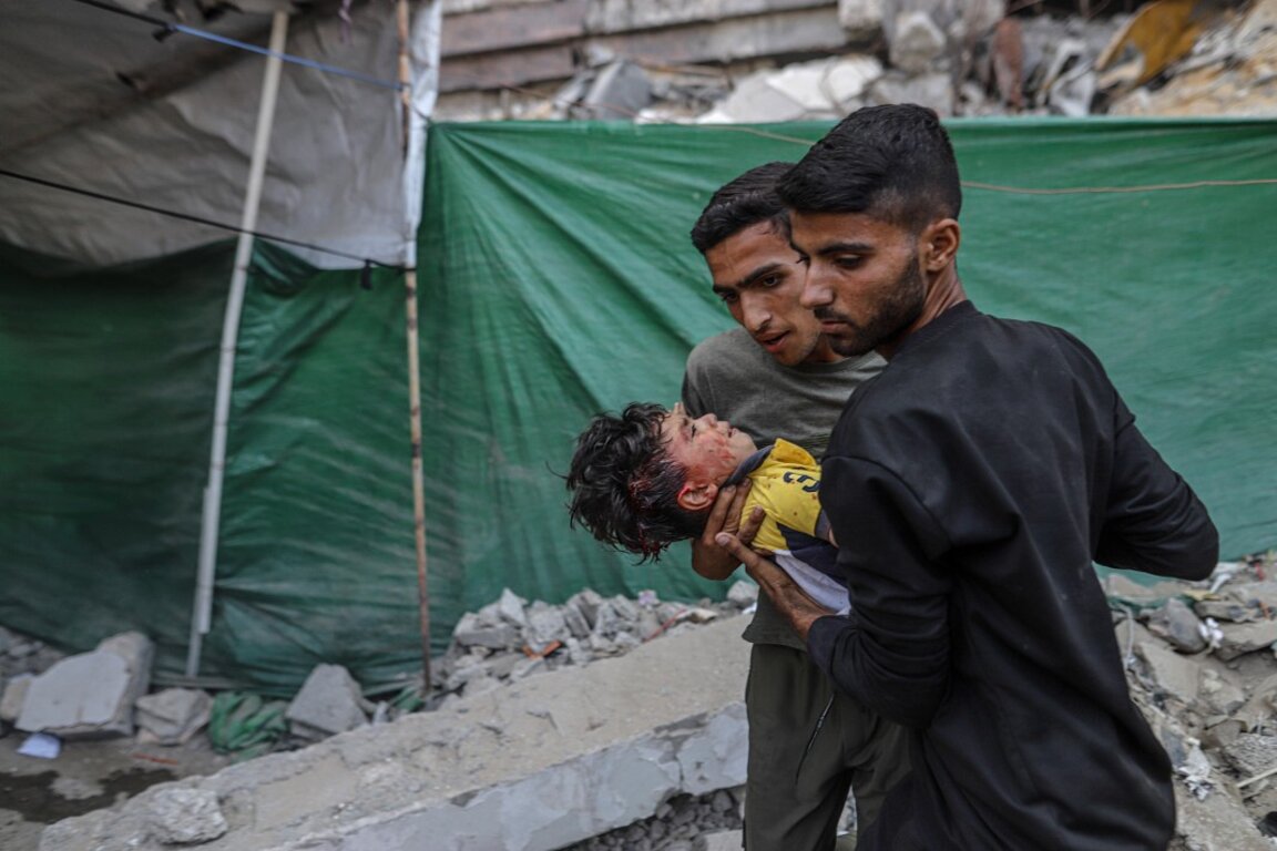 Вътрешно разселени палестинци носят ранено дете след израелски въздушен удар в квартал Ал Ремал в град Газа, 3 юни 2025 г.