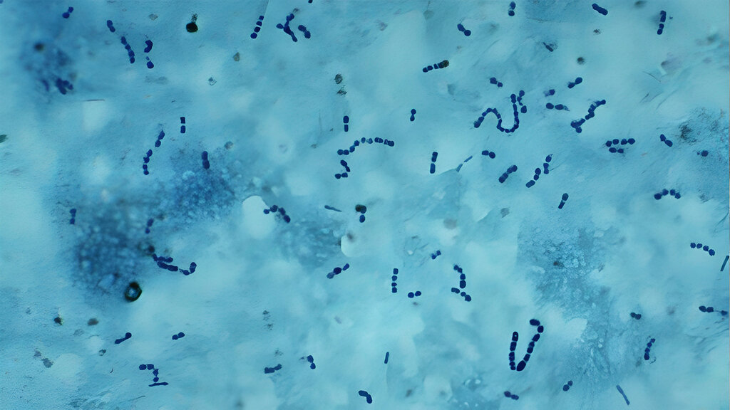 Lactobacillus delbrueckii subsp. bulgaricus