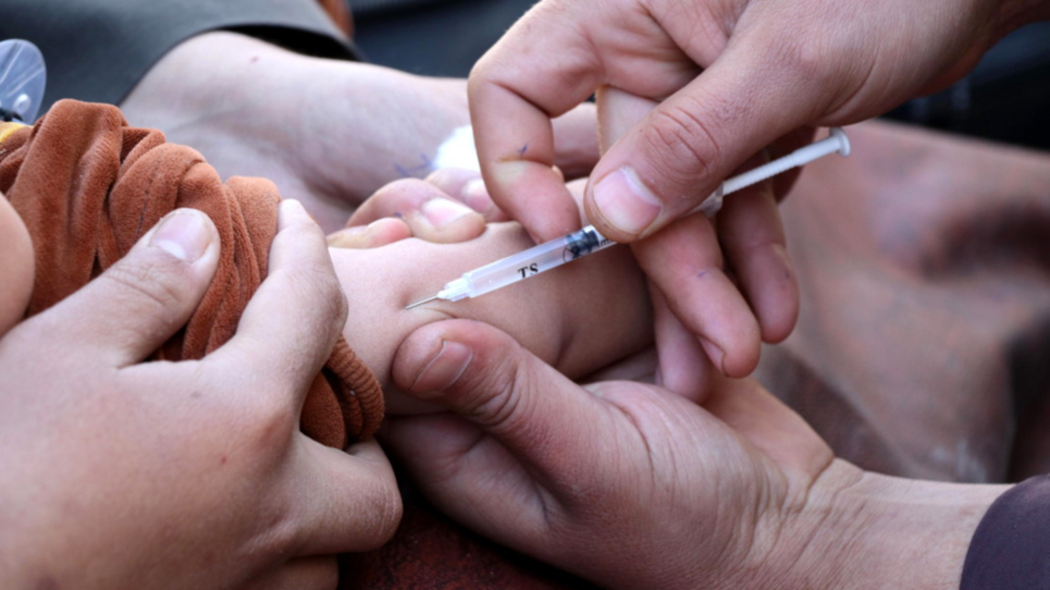 морбили шарка ваксинация