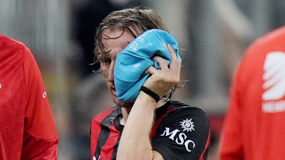 Модрич напуска със счупена скула в мача срещу Ювентус.