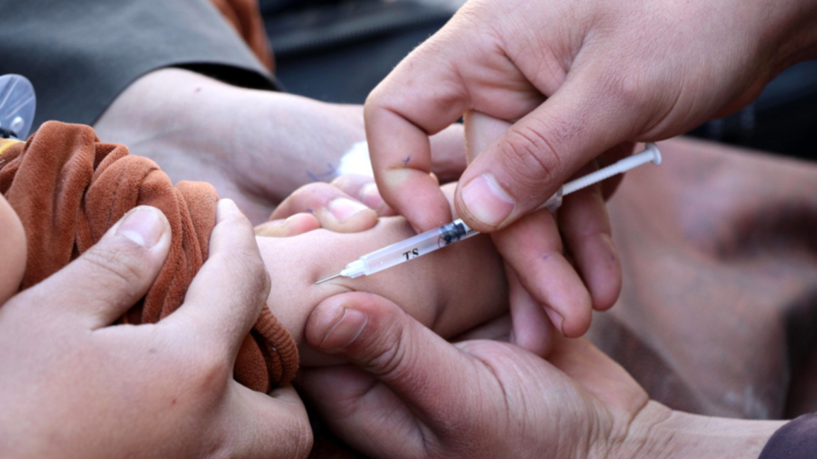 Продължава разпространението на заразата от морбили