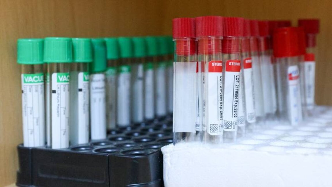 Masa të përkohshme kundër epidemisë për shkak të përhapjes së kollës së mirë