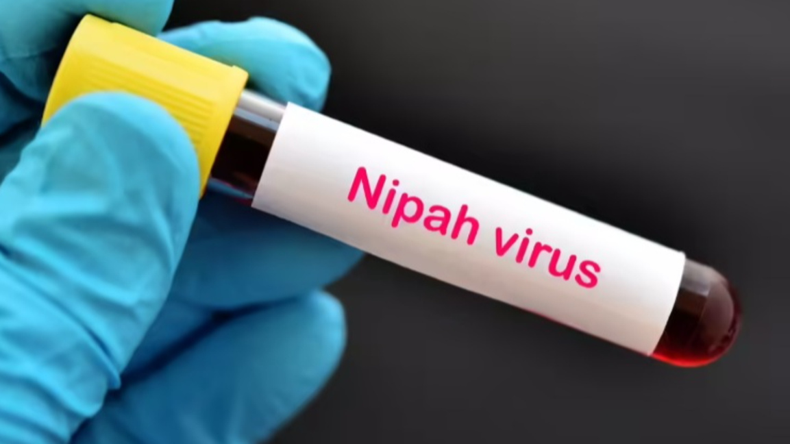Има ли риск вирусът Нипа да повтори пандемията от Covid-19?